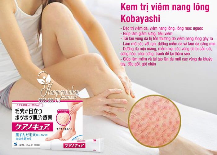 Đôi chân mịn màng, không còn dấu hiệu viêm nang lông sau khi sử dụng sản phẩm chăm sóc da từ Nhật Bản