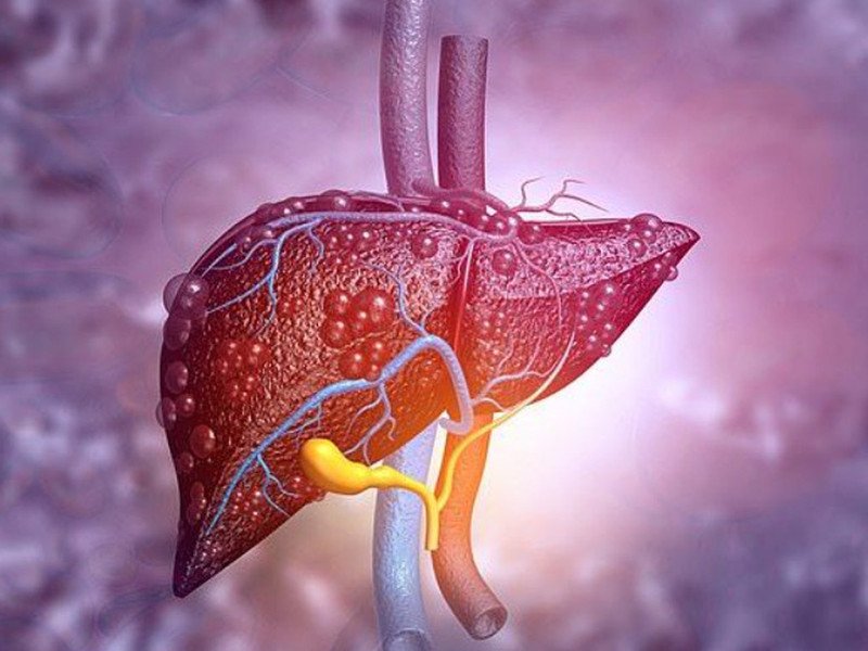 Gan bị nhiễm độc, ảnh hưởng chức năng