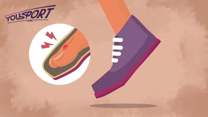 Hậu quả khi chọn sai form giày đá bóng không phù hợp