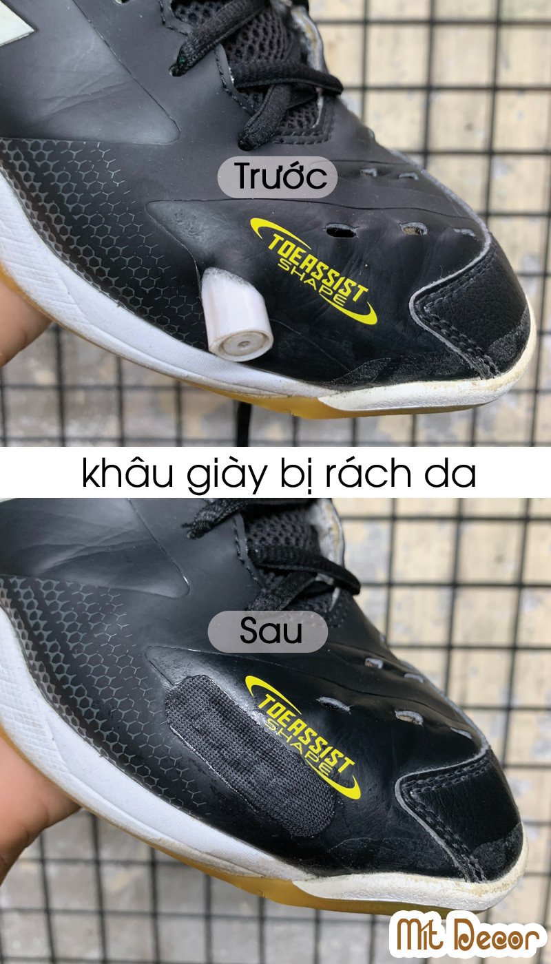 Khâu giày bị rách da