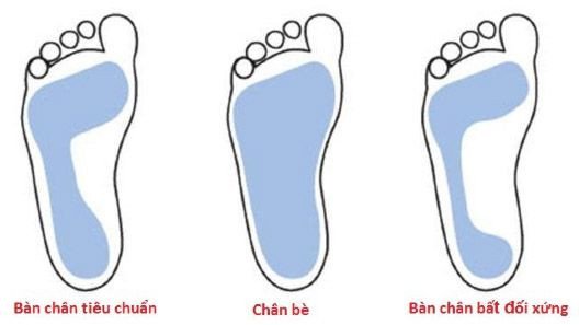 Phân biệt các loại form chân: thon, tiêu chuẩn và bè